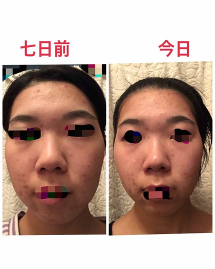 はとむぎ美肌マスク/はとむぎ本舗/シートマスク・パックを使ったクチコミ(2枚目)