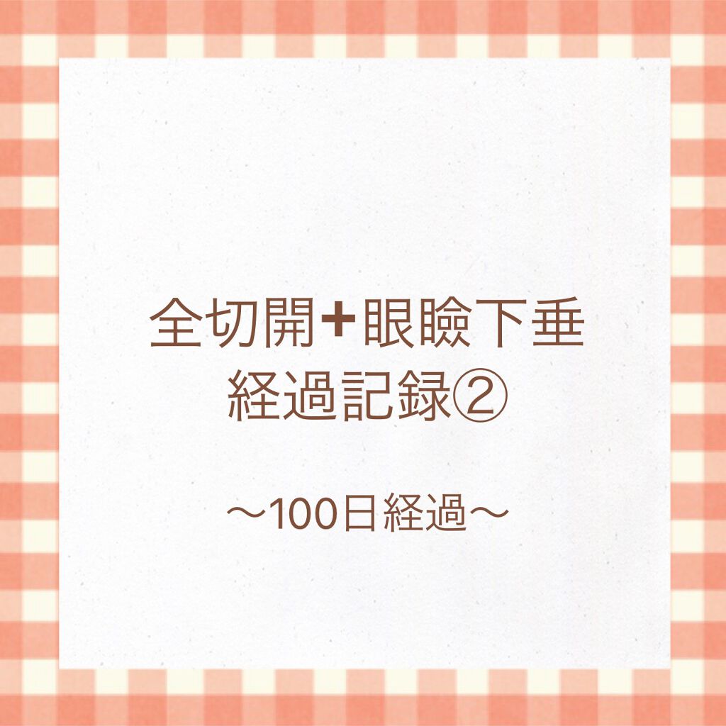MIMI on LIPS 「みなさんお久しぶりです☺️今日ちょうど100日経過という事で更..」(1枚目)