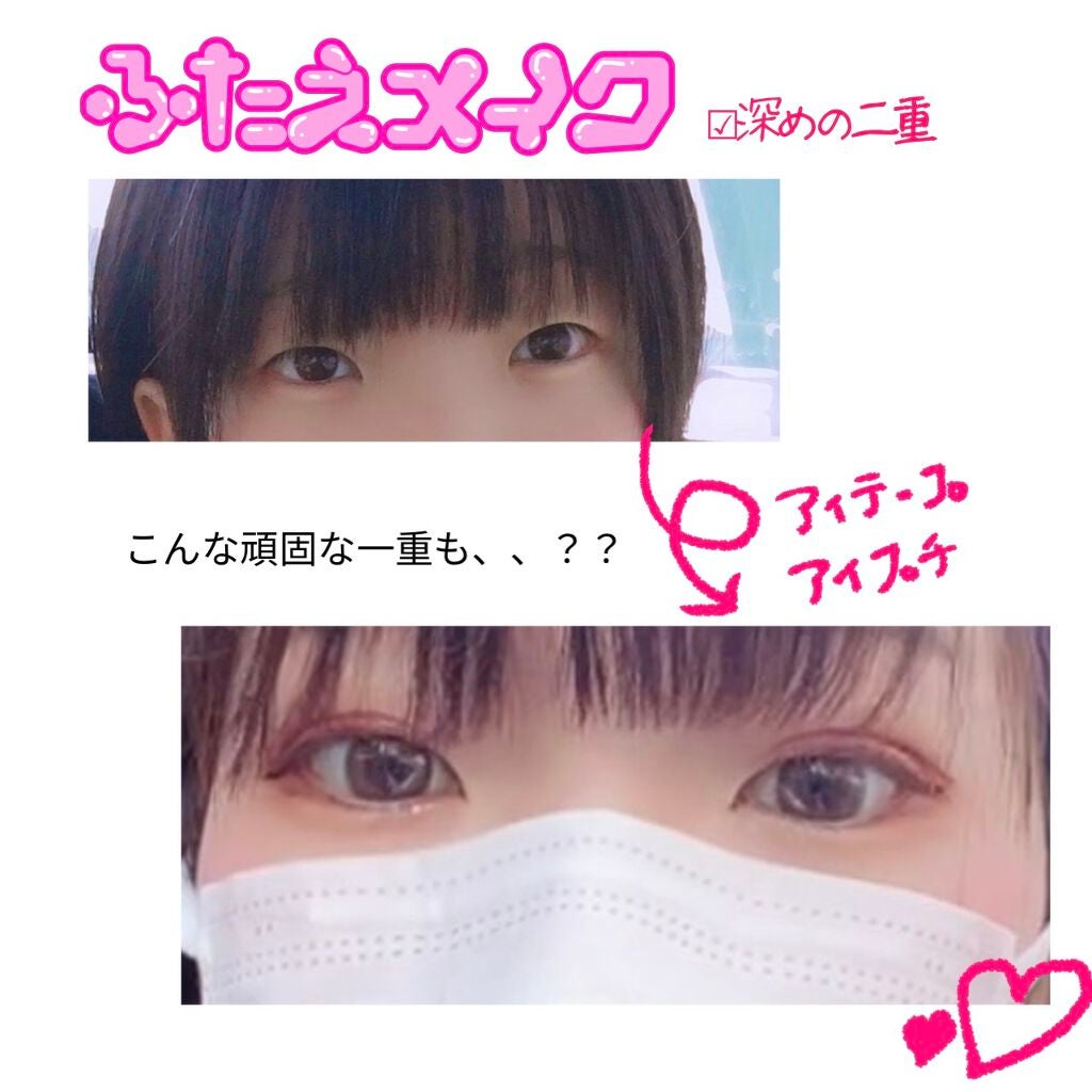 のびーるアイテープ(絆創膏タイプ、レギュラー)/DAISO/二重まぶた用アイテムを使ったクチコミ(1枚目)