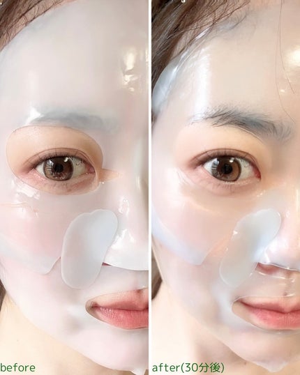 レチA リードルショット100 2ステップハイドロゲルマスク/VT/シートマスク・パックを使ったクチコミ(5枚目)