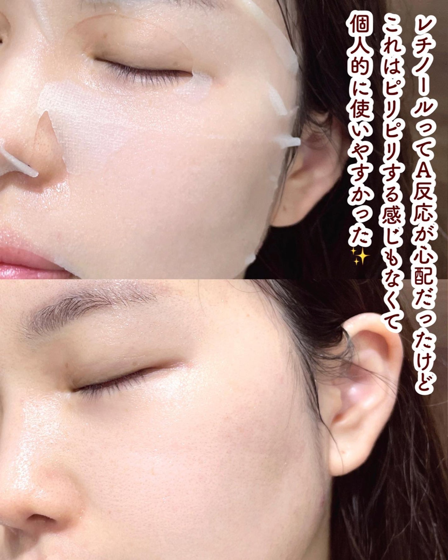 ダーマレーザー スーパーレチノール100マスク/クオリティファースト/シートマスク・パックを使ったクチコミ(5枚目)