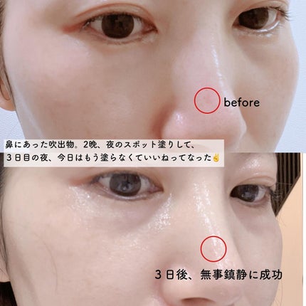 スリープアンドピールマスクパック/MIDAMSU/洗い流すパック・マスクを使ったクチコミ(4枚目)