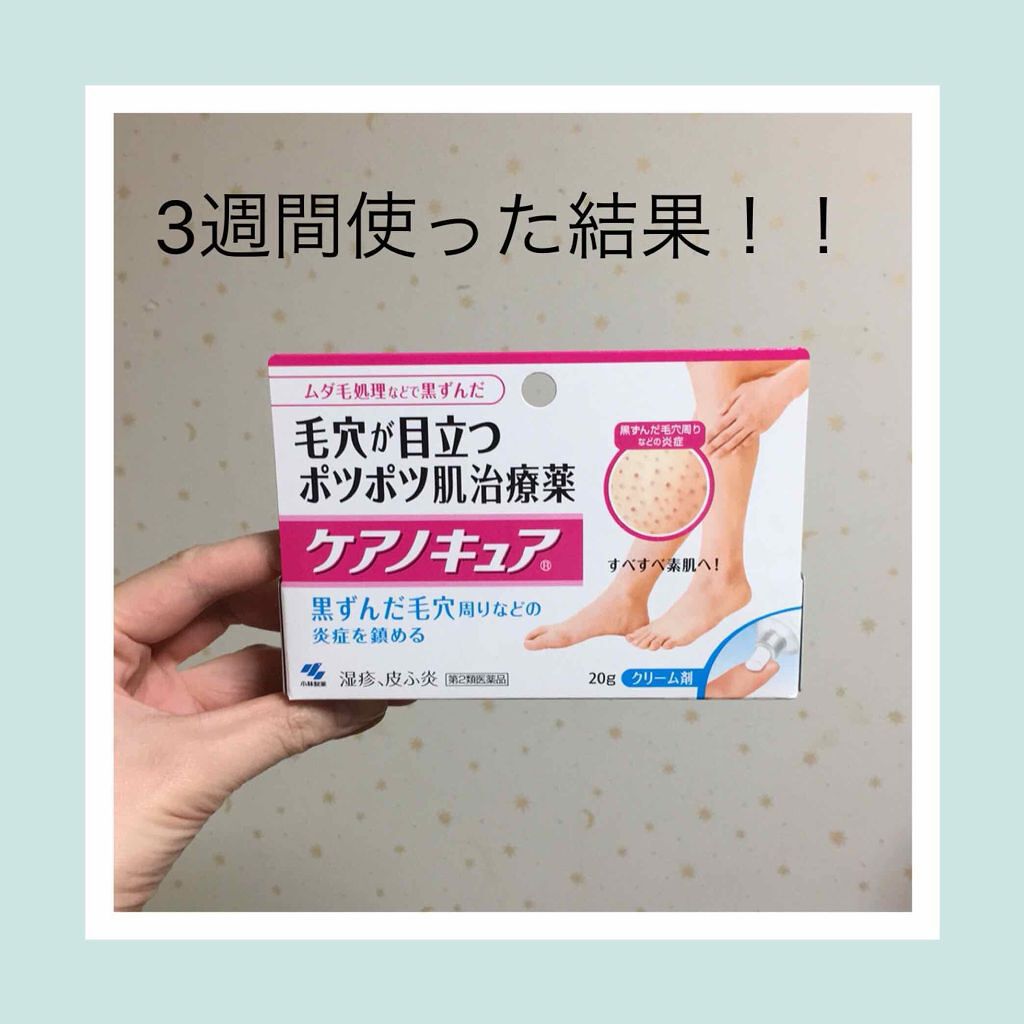ケアノキュア（医薬品）/小林製薬/その他を使ったクチコミ（1枚目）