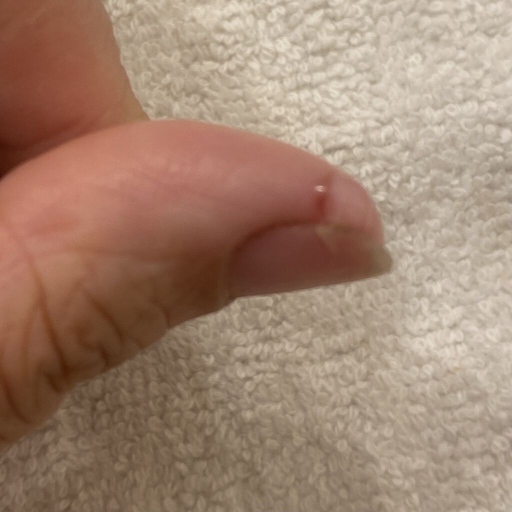 プラスジェル 消毒液/JPS(ジェーピーエス)/その他スキンケアを使ったクチコミ（3枚目）