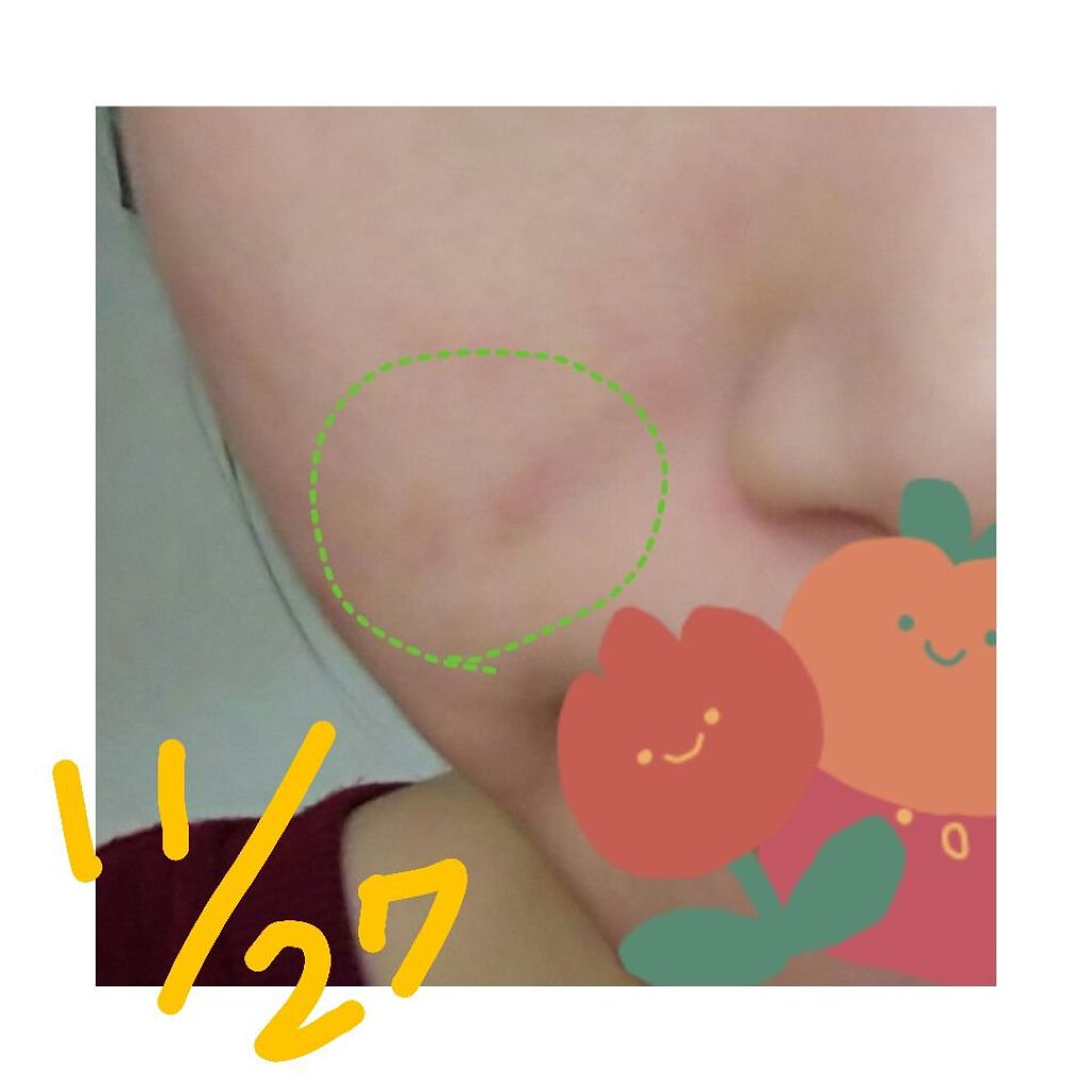 オバジC10セラム/オバジ/美容液を使ったクチコミ（3枚目）