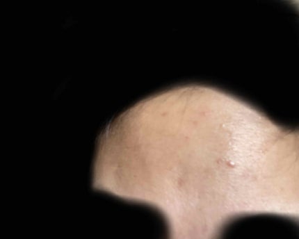 pink_sounds_rrza on LIPS 「べピオゲル14日目すごい綺麗になってる、肌触ってもざらざらしな..」(5枚目)