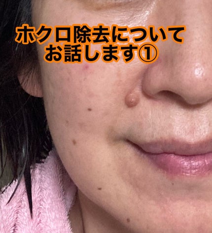 を使ったクチコミ(1枚目)