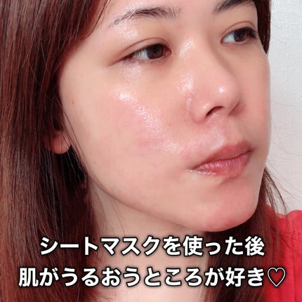 ルルルン ハイドラ EX マスク/ルルルン/シートマスク・パックを使ったクチコミ(6枚目)
