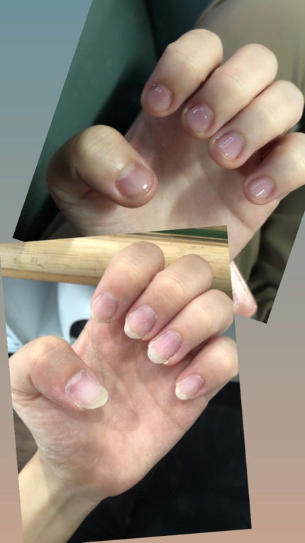 フラワーネイルオイル N/JILL STUART/ネイルオイル・トリートメントを使ったクチコミ(1枚目)