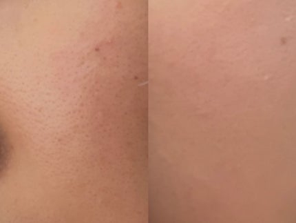 キル カバー ファンウェア クッション エックスピー/CLIO/クッションファンデーションを使ったクチコミ(2枚目)