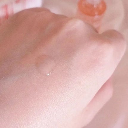 バイオイル/バイオイル/フェイスオイルを使ったクチコミ(4枚目)