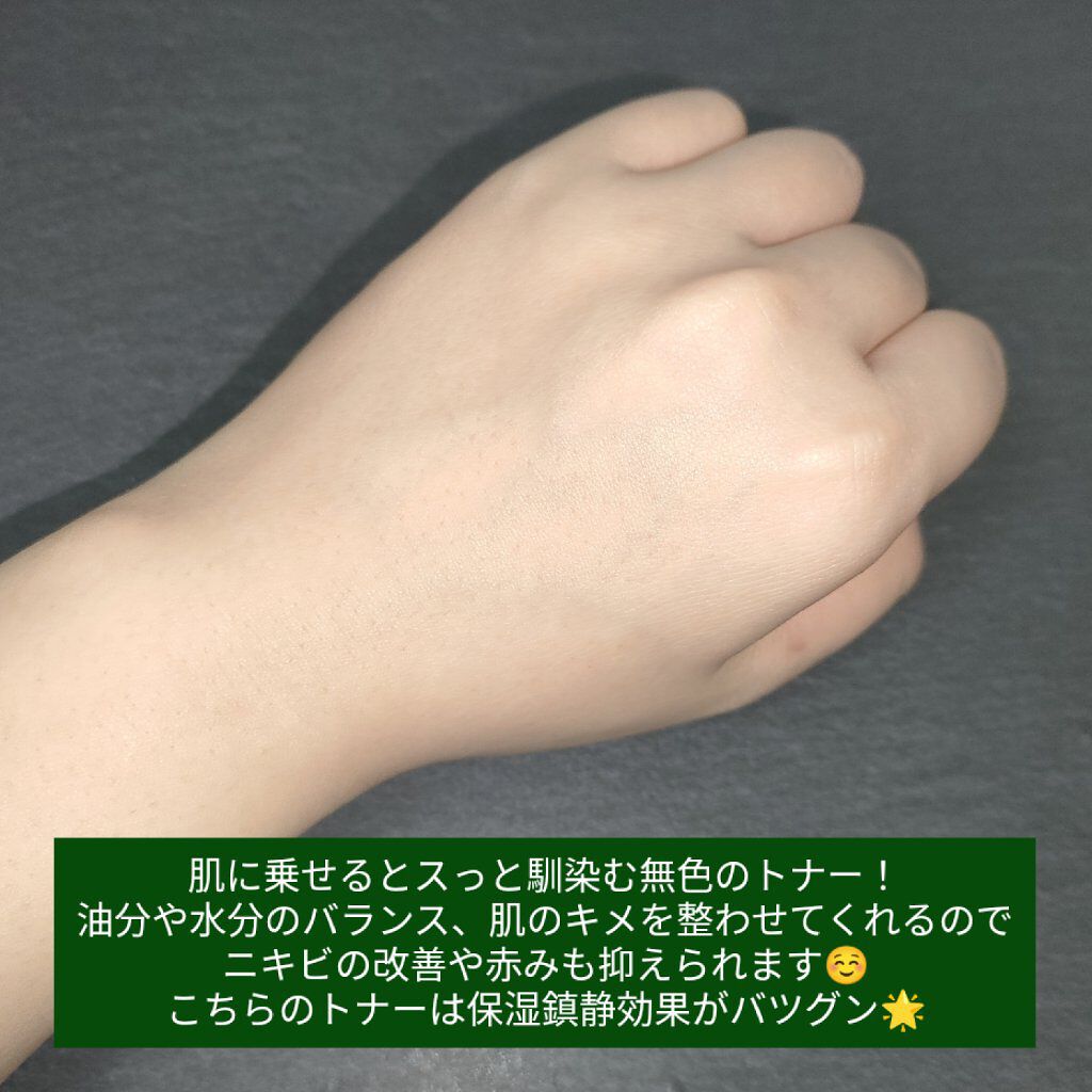 ドクダミ 77 スージングトナー/Anua/化粧水を使ったクチコミ（3枚目）