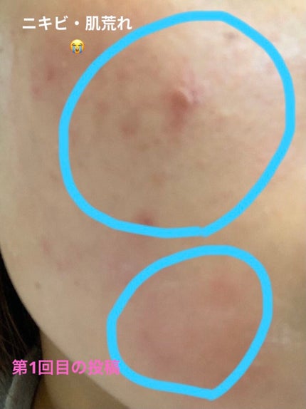 を使ったクチコミ(3枚目)