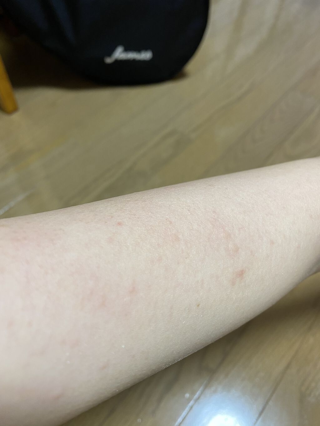 除毛クリーム シトラスホワイトリリィ/スリンキータッチ セルフスパ/除毛クリームを使ったクチコミ（3枚目）