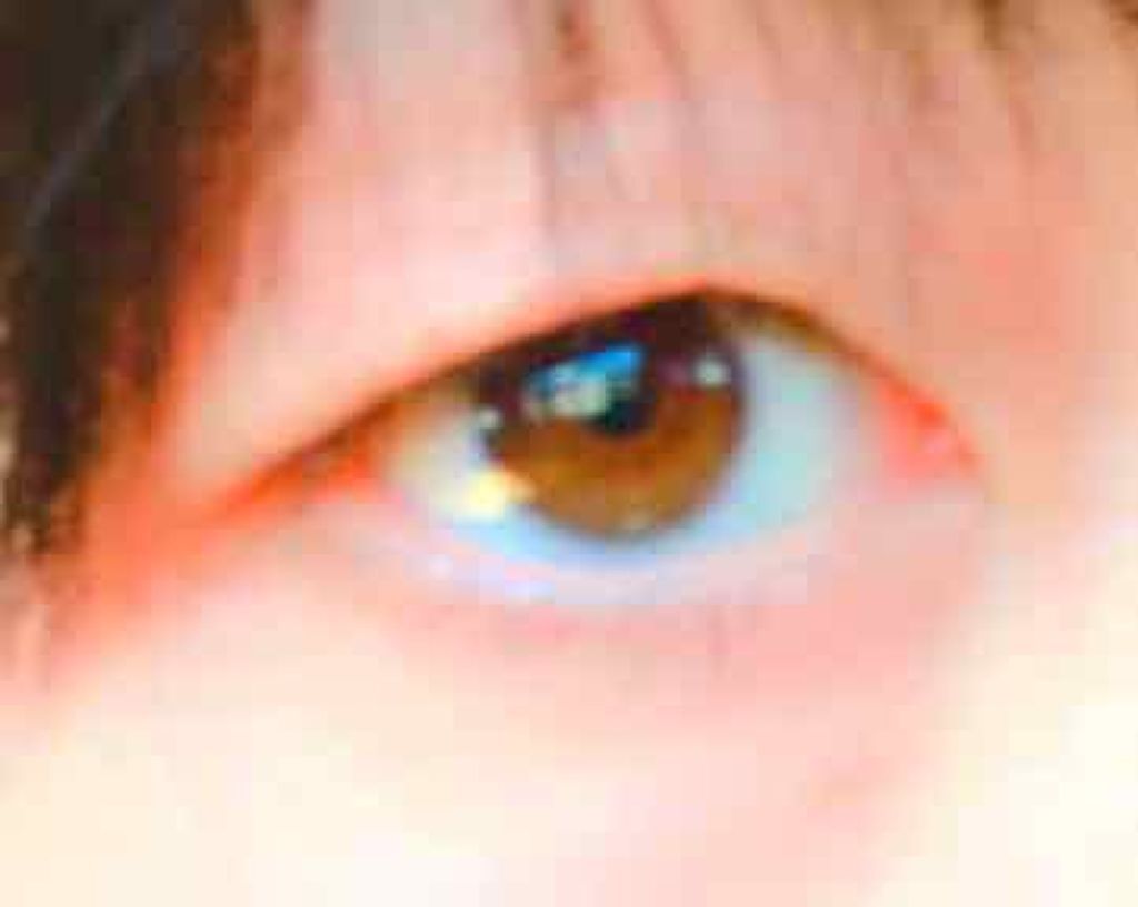 さいきc 治療クリーム（医薬品）/Saiki/その他を使ったクチコミ（2枚目）