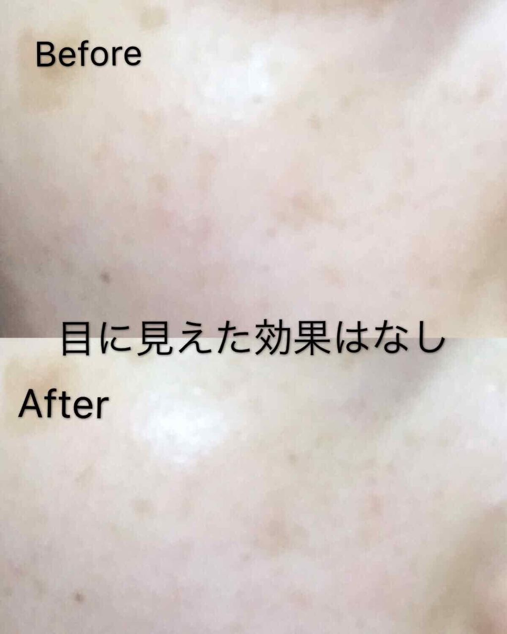 《送料無料》SK-Ⅱ フェイシャルトリートメントエッセンス〈一般肌用化粧水〉75ml 新品 エスケーツー