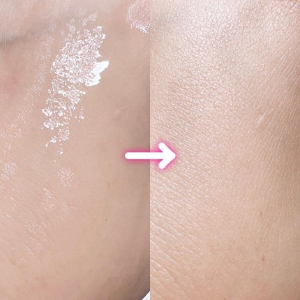 ãªãããæ¬è æŽèçŸå®¹æ¶² NC/ãªãããæ¬è/çŸå®¹æ¶²ã䜿ã£ãã¯ãã³ãïŒ4æç®ïŒ