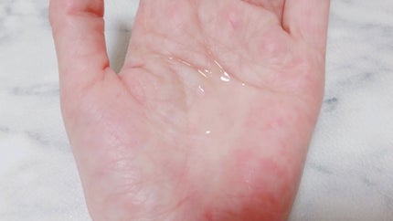 p/d ローションプラス/p/d/化粧水を使ったクチコミ(4枚目)