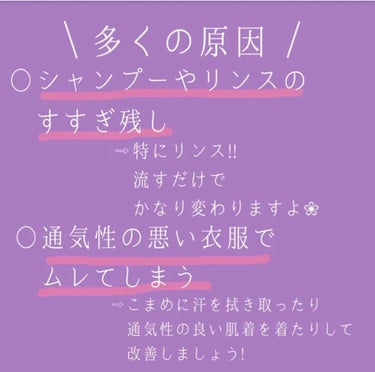 ♡せーにゃん♡🌷 on LIPS 「❀もう背中ニキビとはおさらば❀𓂃背中ニキビの対策方法𓂃𓈒𓏸𓐍今..」（2枚目）