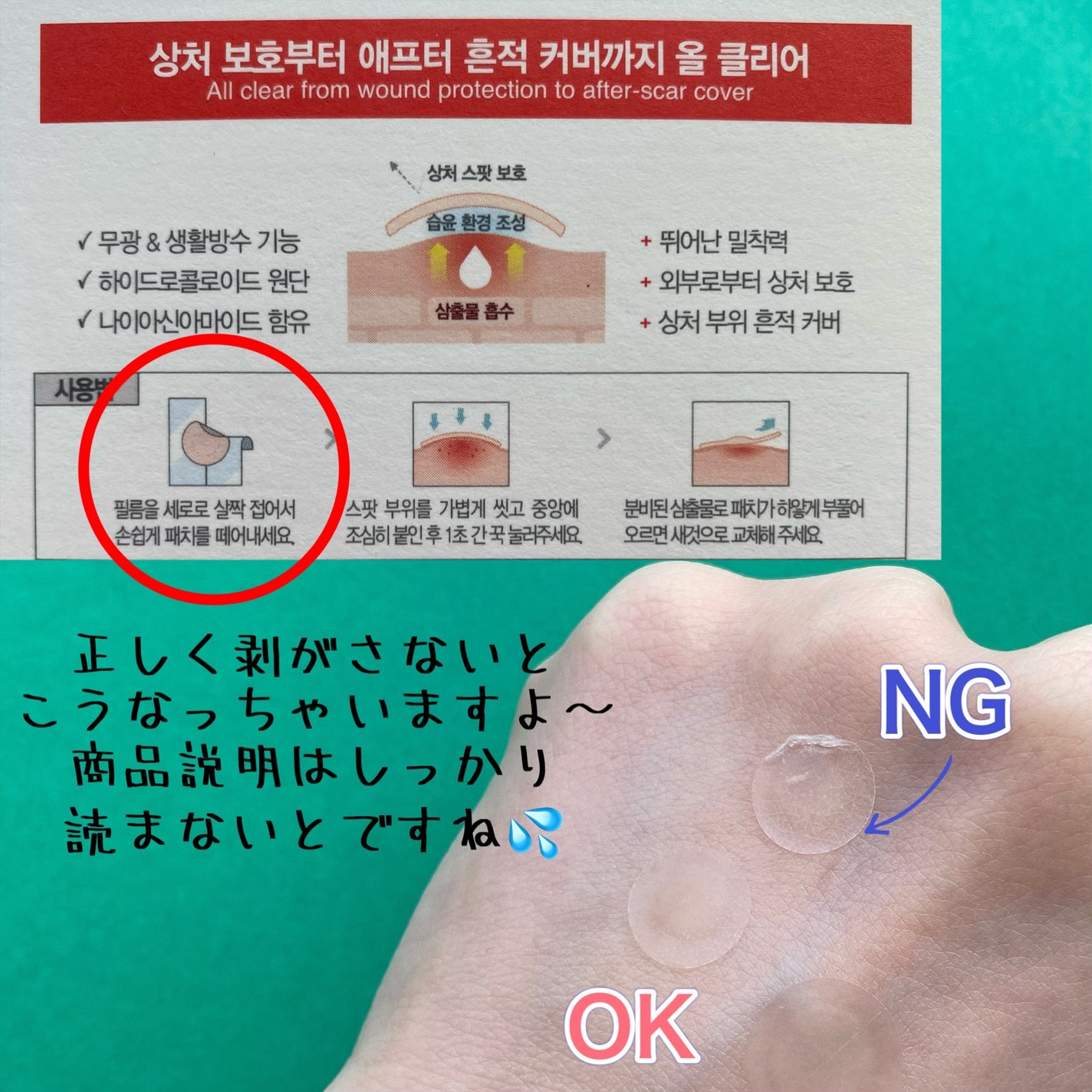 エイクリアスポットキュアパッチ/Dr.G/その他スキンケアを使ったクチコミ(7枚目)