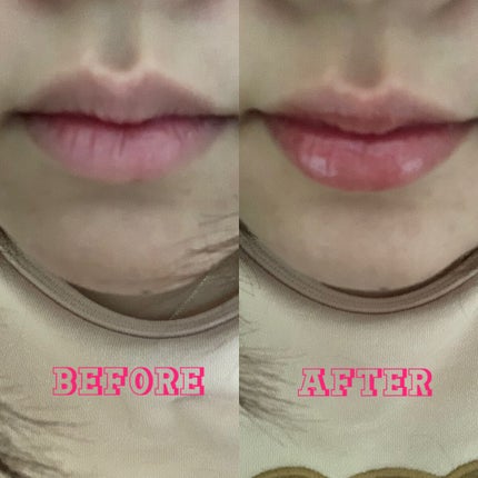 リップフォンデュ/メンソレータム/リップバームを使ったクチコミ(2枚目)