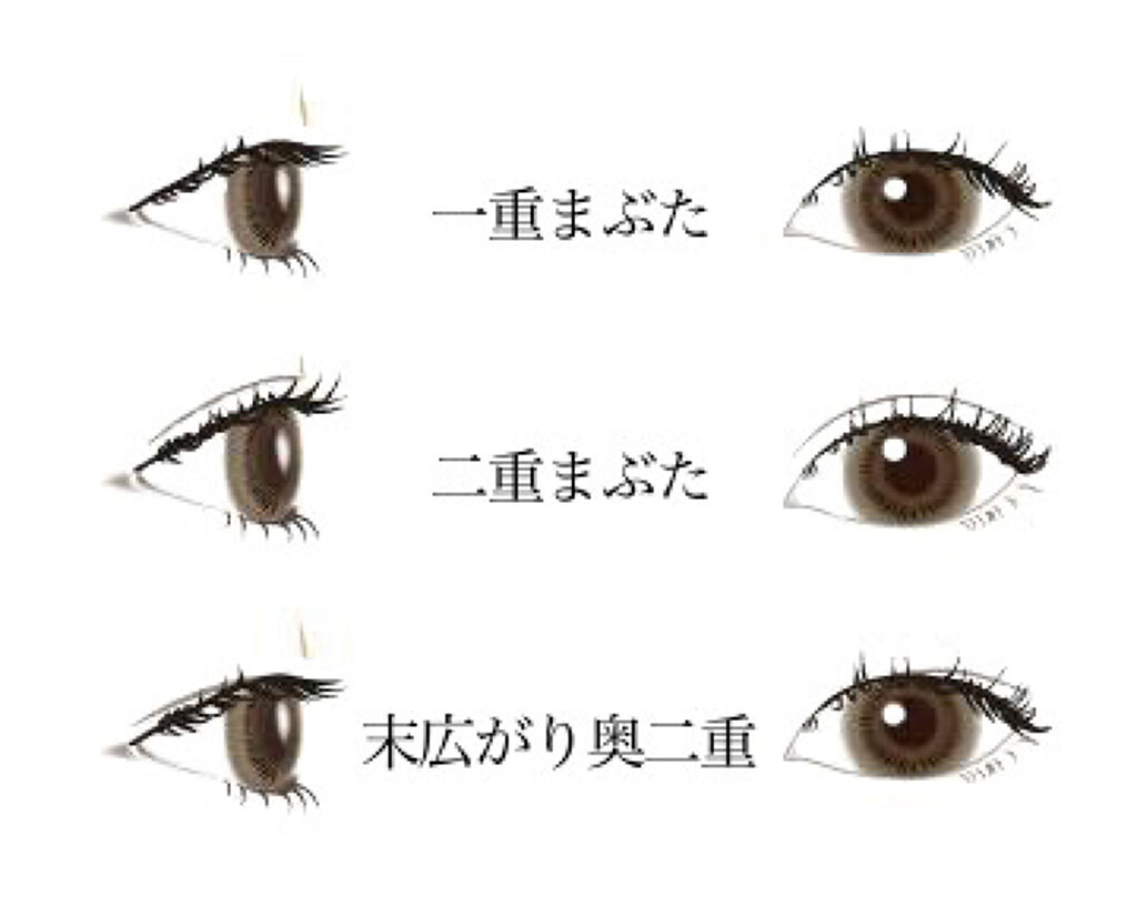 のびーるアイテープ（絆創膏タイプ、レギュラー）/DAISO/二重まぶた用アイテムを使ったクチコミ（2枚目）