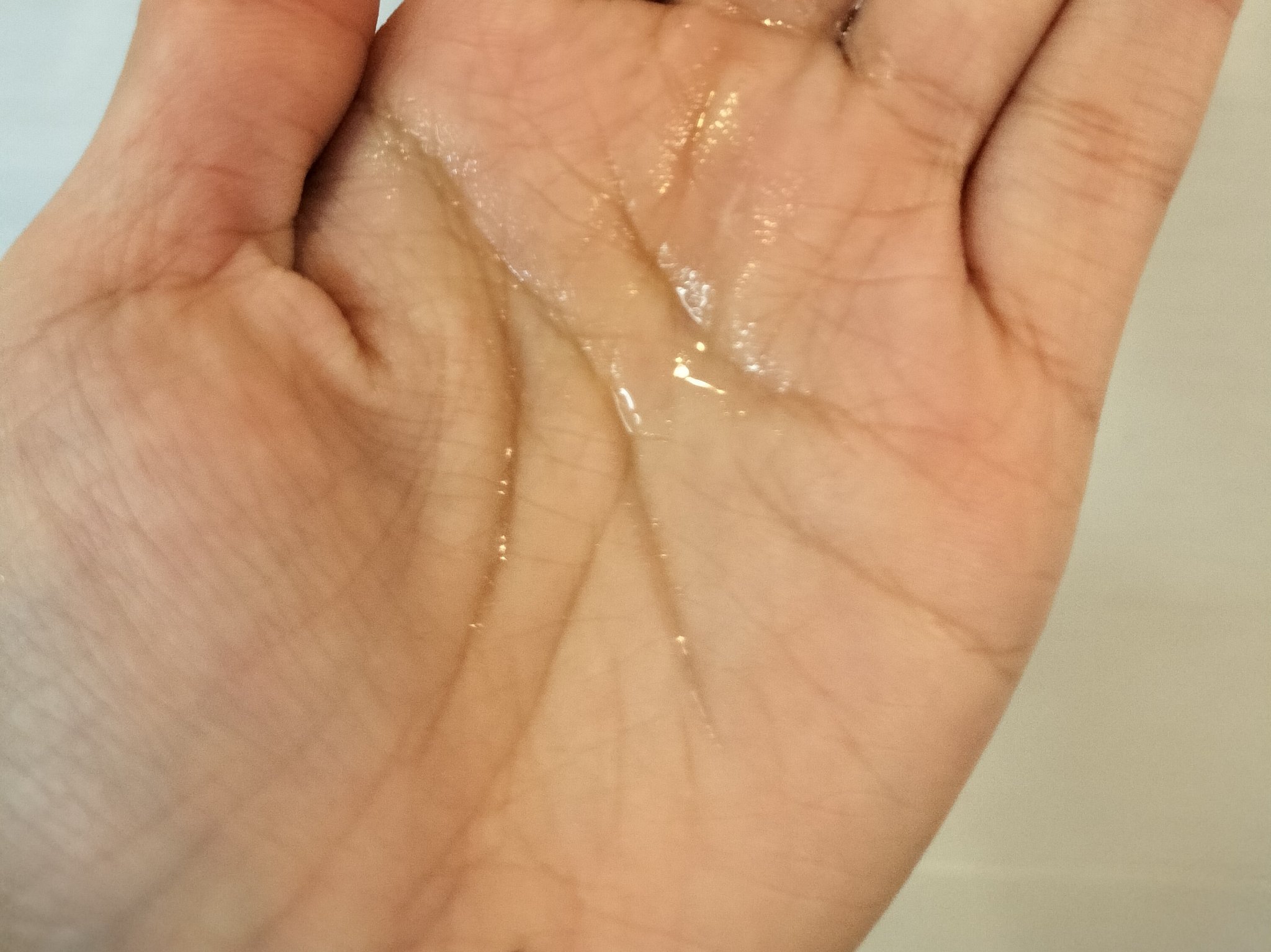 薬用育毛剤/マイナチュレ/頭皮ローションを使ったクチコミ（2枚目）