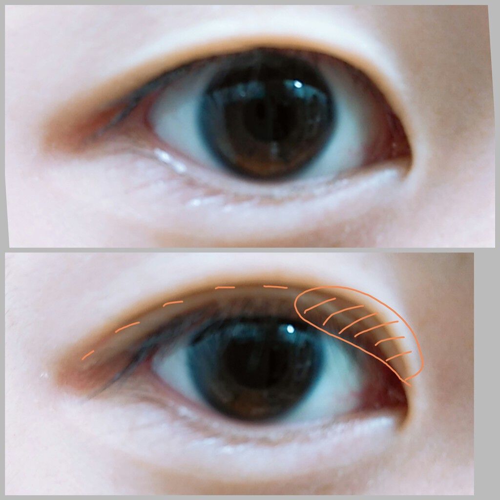 アイビューティー フィクサー WP/アストレア ヴィルゴ/二重まぶた用アイテムを使ったクチコミ（2枚目）