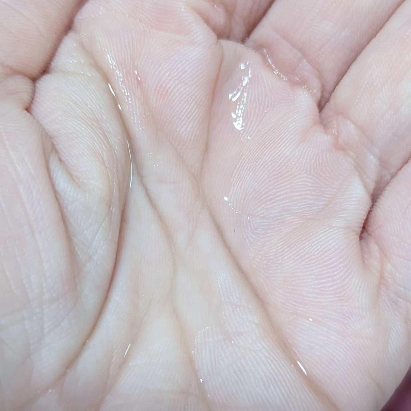 タカミスキンピール/タカミ/ブースター・導入液を使ったクチコミ(3枚目)