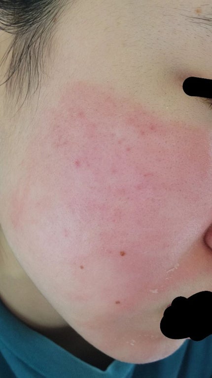 を使ったクチコミ(1枚目)