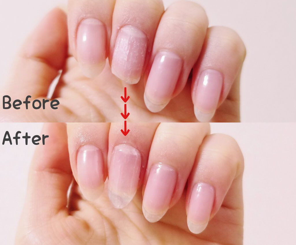 オホーラ プログロッシートップジェル/ohora/ジェルネイルを使ったクチコミ（2枚目）