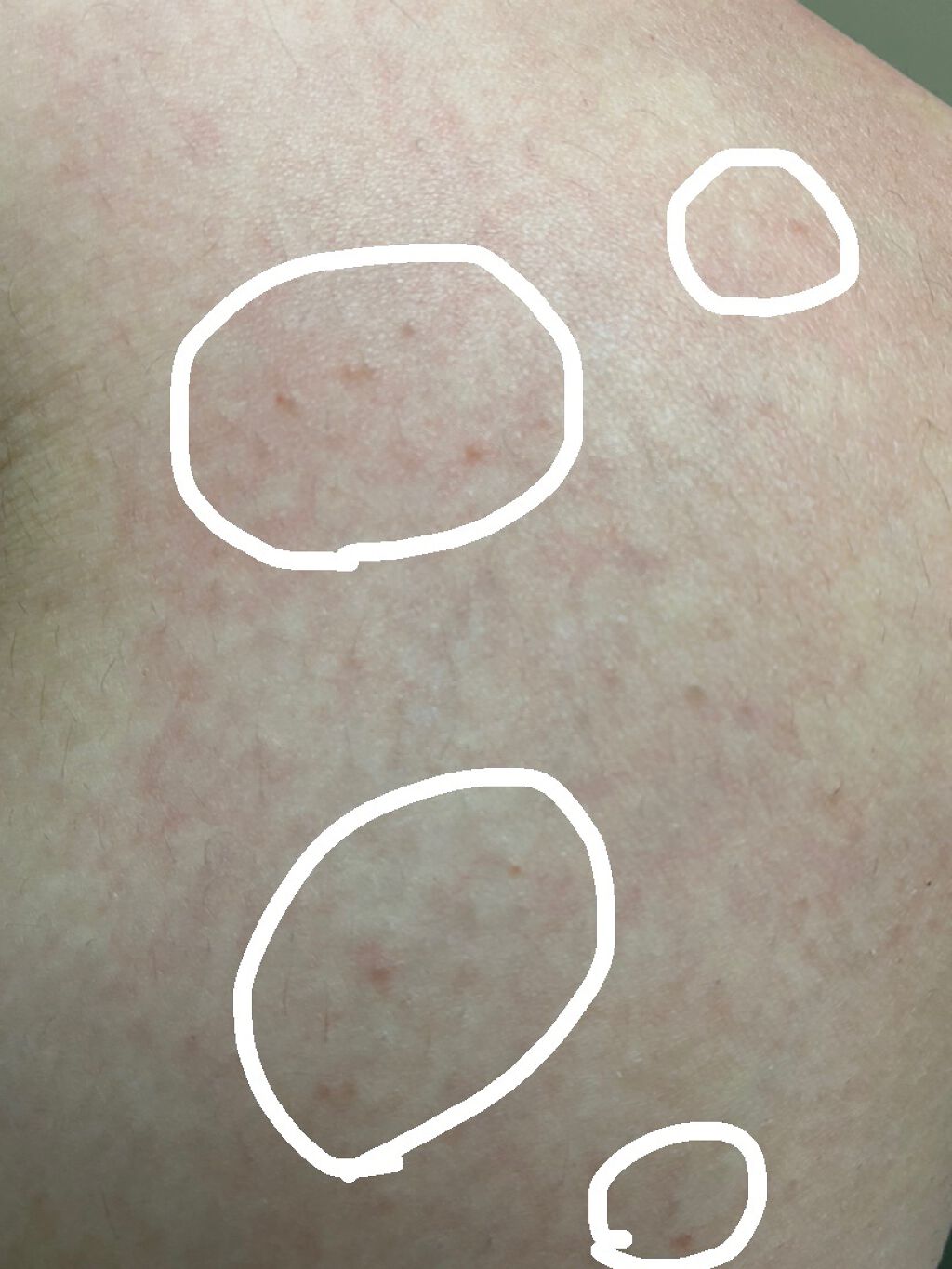 アロエスキンクリーム 100g/DAISO/フェイスクリームを使ったクチコミ（3枚目）