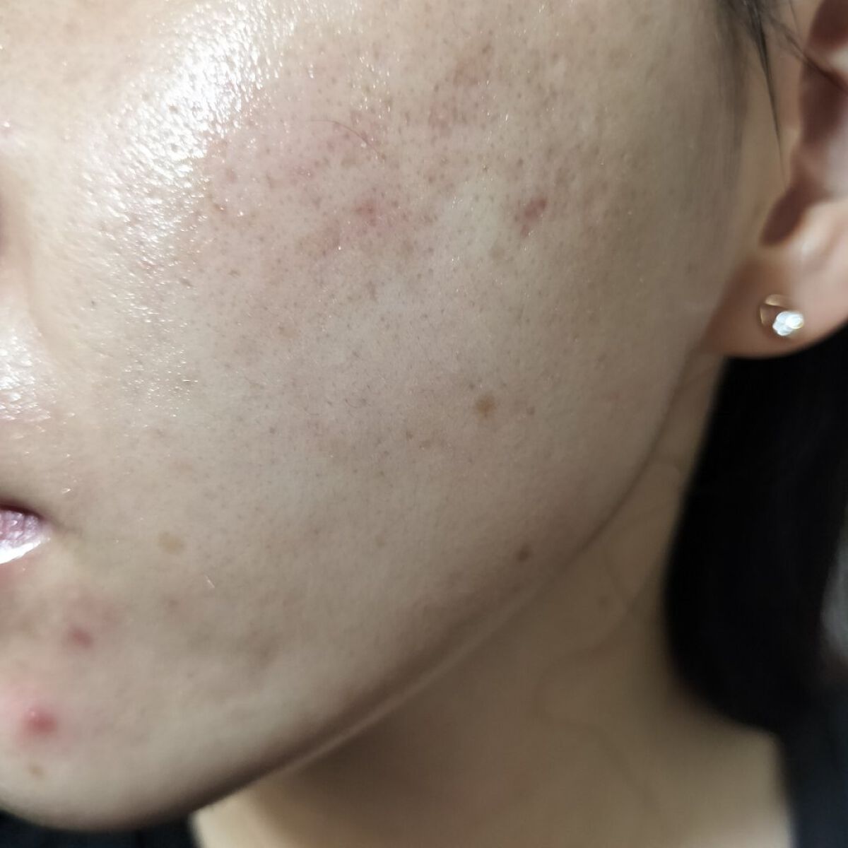 マデカソ 美容液/A’pieu/美容液を使ったクチコミ（2枚目）