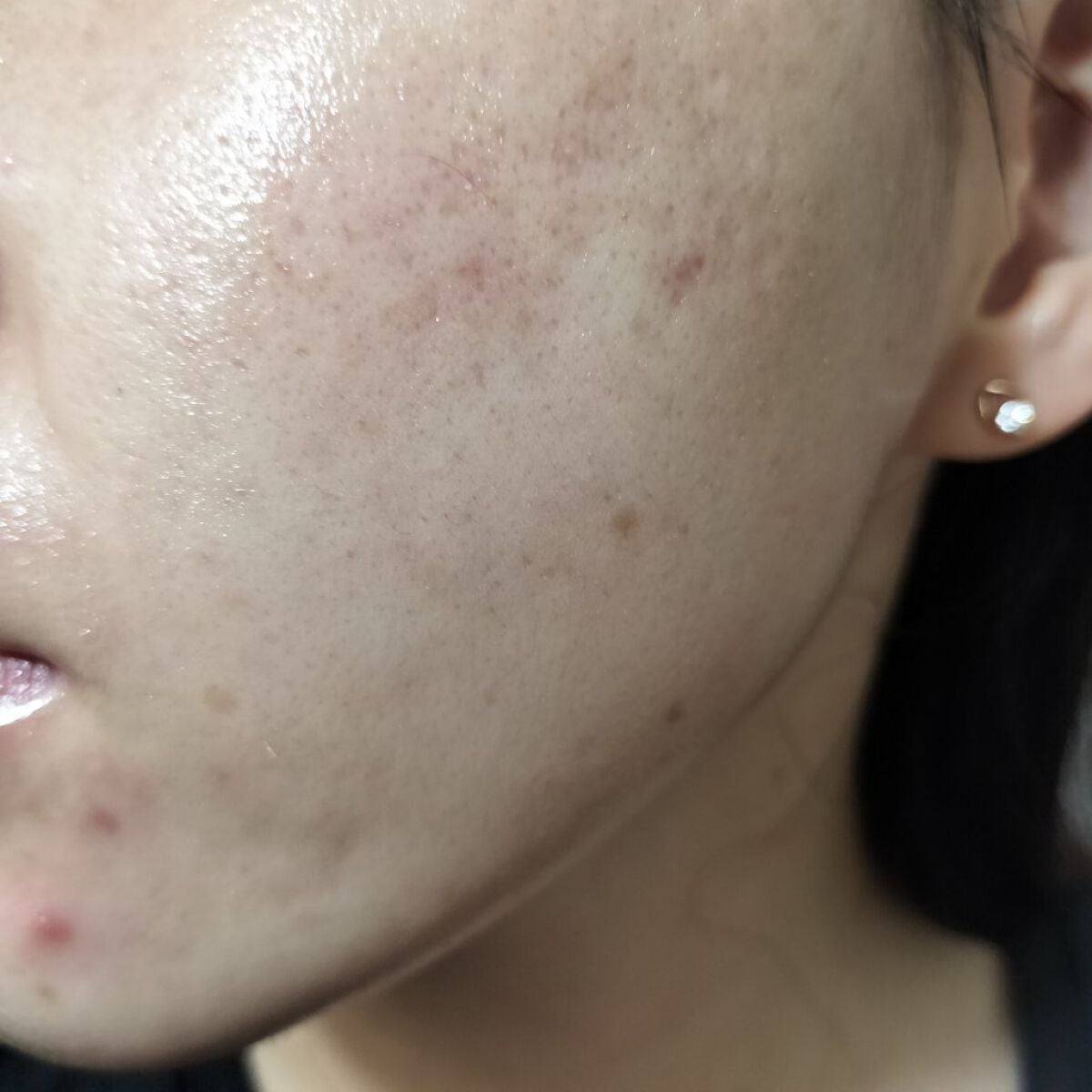 マデカソ 美容液/A’pieu/美容液を使ったクチコミ(2枚目)