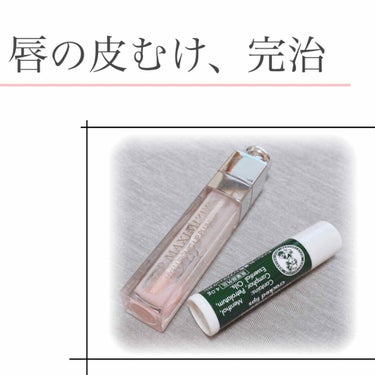 最強リップケア💄💋
これで唇の皮むけがなくなりました！


私は今まで、リップを塗ってしばらくすると
唇の皮がペリペリむけてしまっていました💧

そのため、リップを塗り直しても上手く塗れませんでた…

