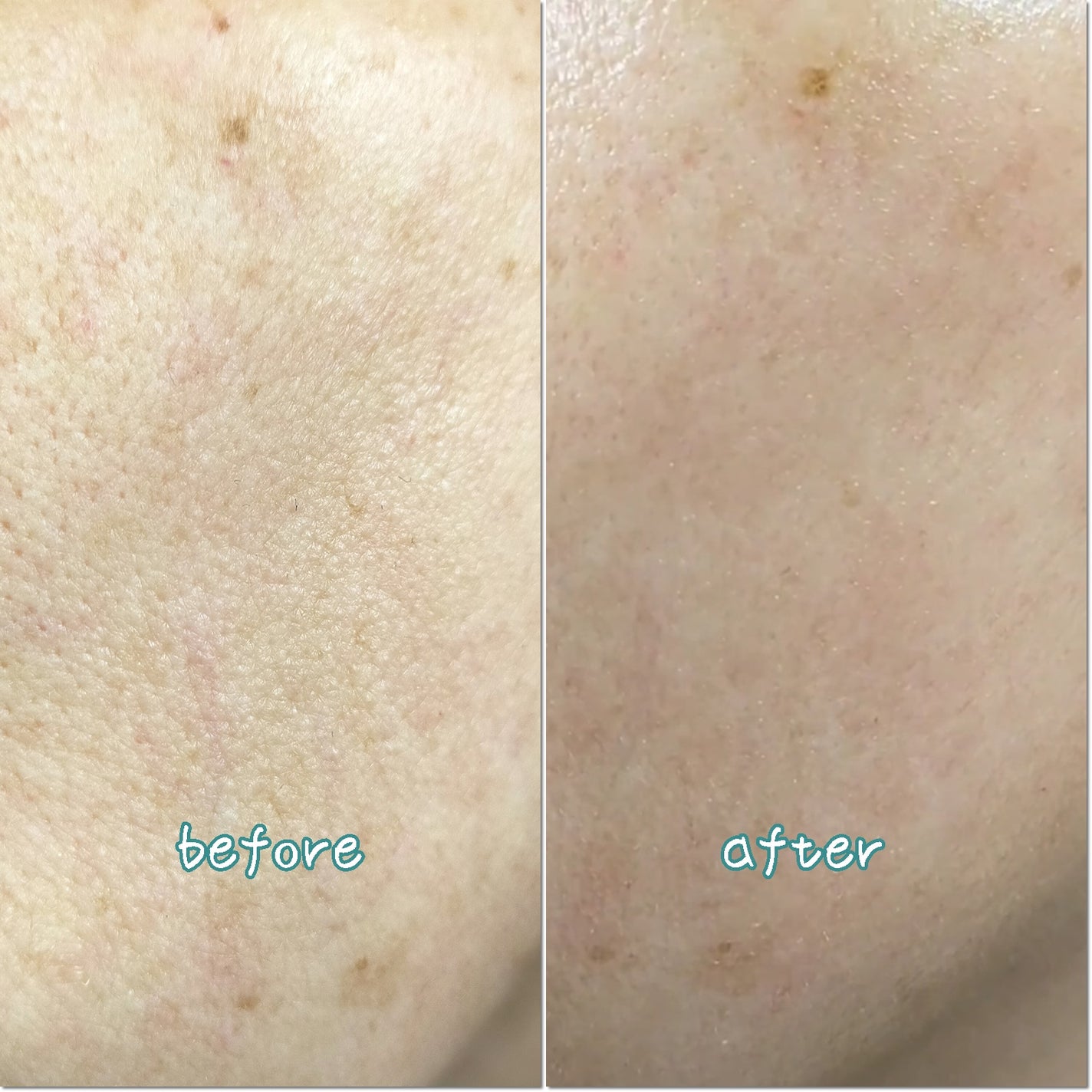 モリンガタイトニングポアセラム/ilso/美容液を使ったクチコミ(5枚目)