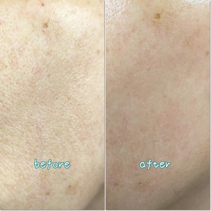 モリンガタイトニングポアセラム/ilso/美容液を使ったクチコミ(5枚目)