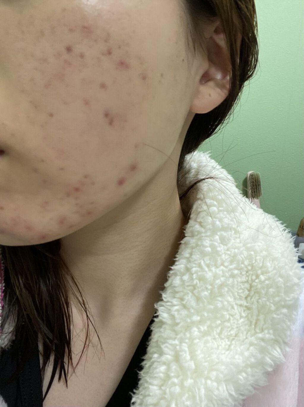 N.M.FアクアアンプルマスクJEX/MEDIHEAL/シートマスク・パックを使ったクチコミ（3枚目）