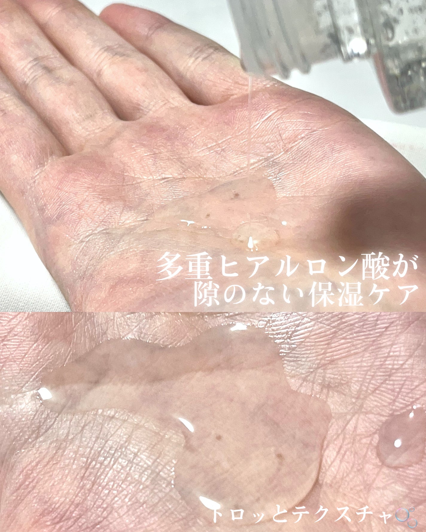 アクアヒアルロニックエッセンス/ロベクチン/化粧水を使ったクチコミ(3枚目)