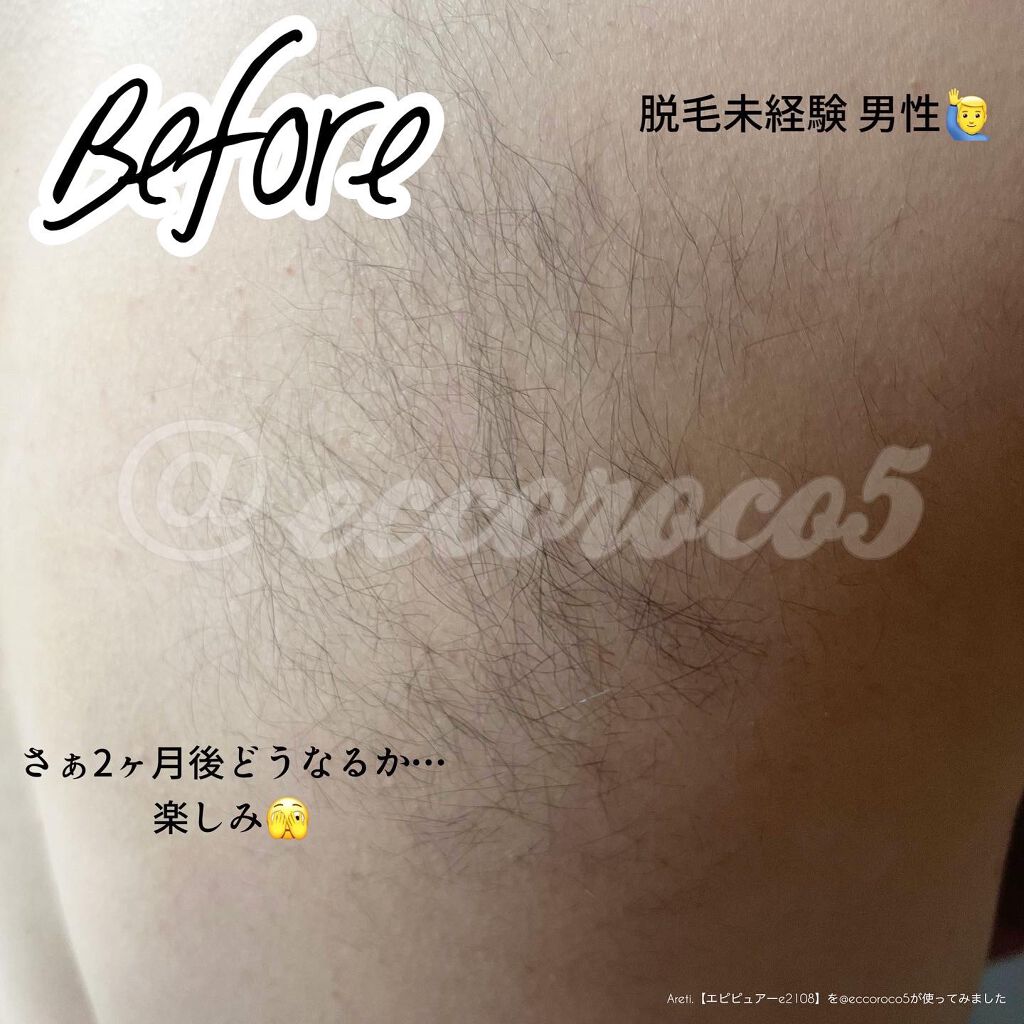 エピピュアーe2108/Areti./ボディケア美容家電を使ったクチコミ（3枚目）