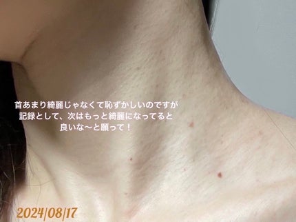 美容原液 オパール R-III/薬用 オパールR-Ⅲ/美容液を使ったクチコミ(10枚目)