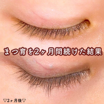 EMAKED(エマーキット)/水橋保寿堂製薬/まつげ美容液を使ったクチコミ(1枚目)