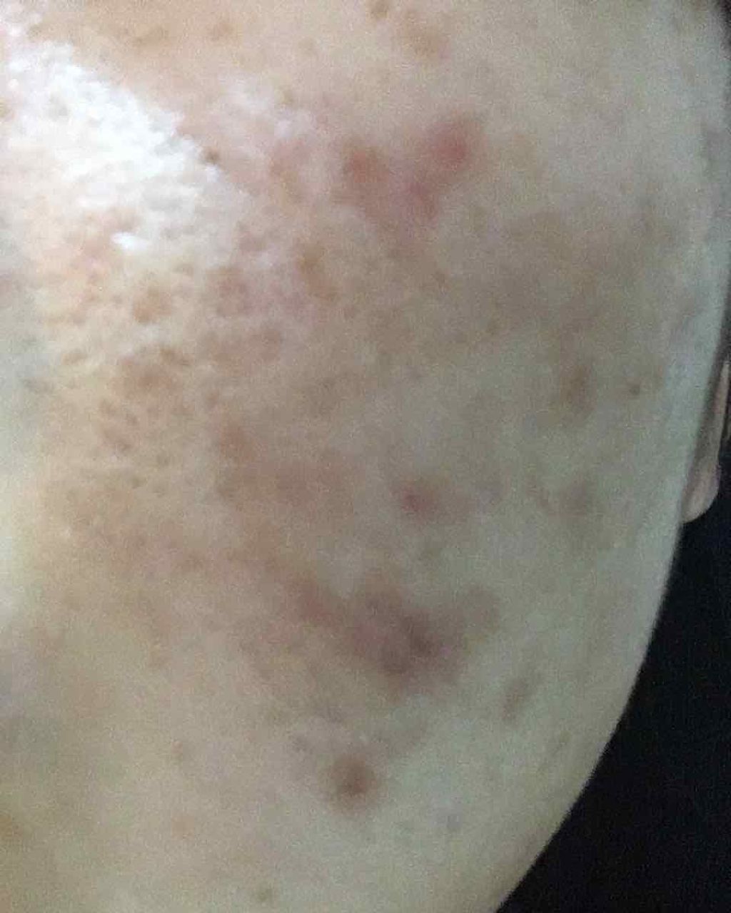 SP クッション ウルトラカバークッション BB/MAYBELLINE NEW YORK/クッションファンデーションを使ったクチコミ(2枚目)