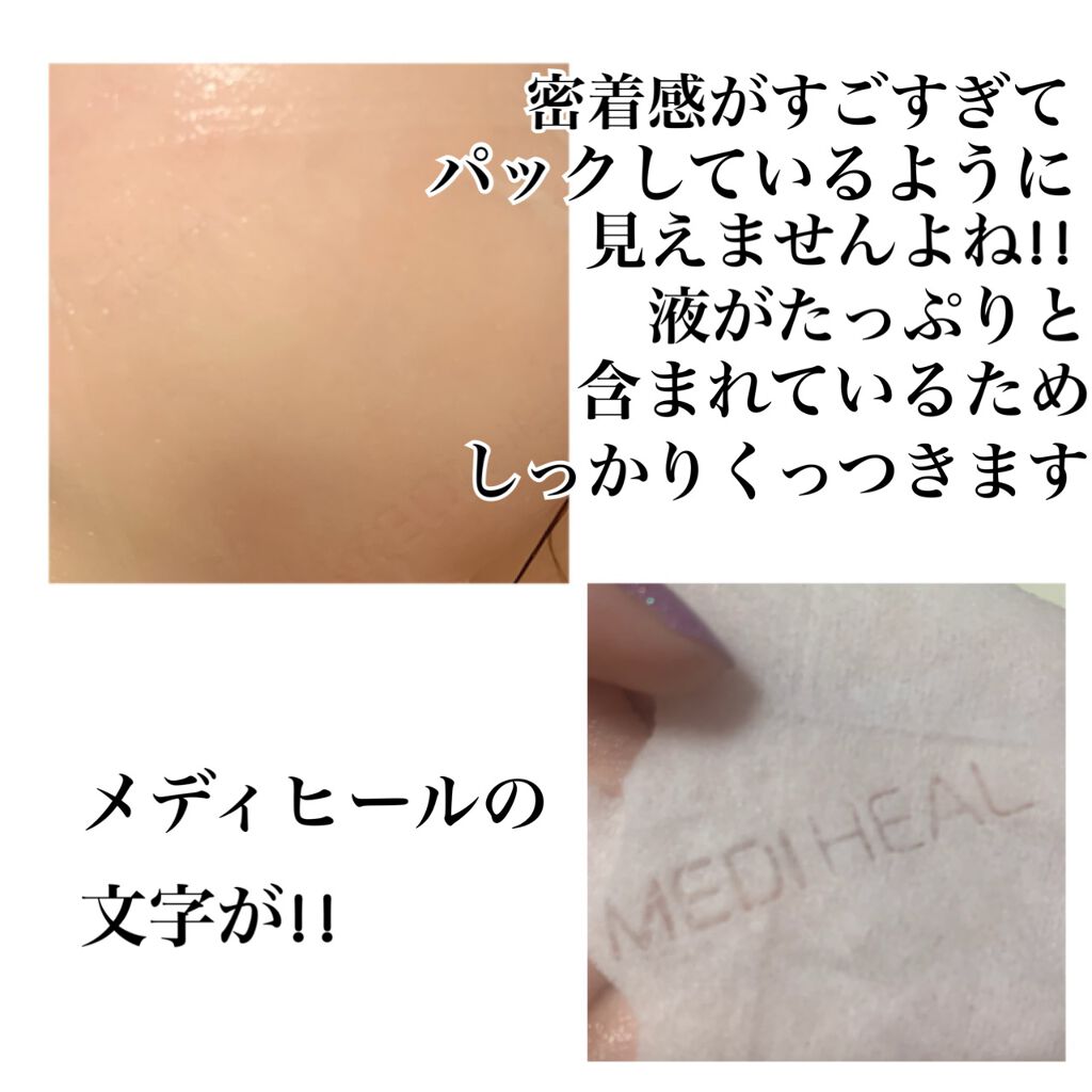 N.M.FアクアアンプルマスクJEX/MEDIHEAL/シートマスク・パックを使ったクチコミ（2枚目）