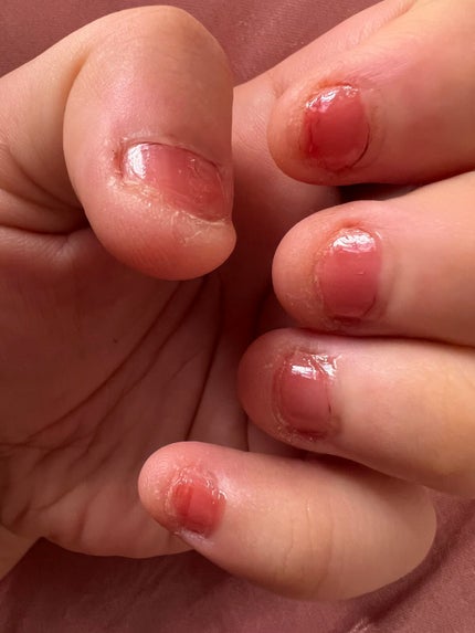 コレガネイル/RICAFROSH/マニキュアを使ったクチコミ(4枚目)