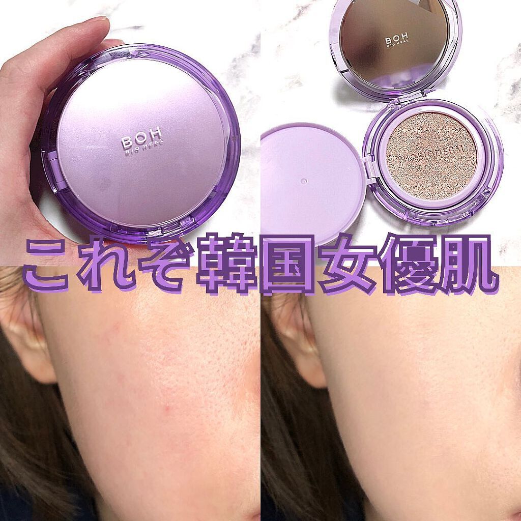 あずさ@スキンケアマニア on LIPS 「これぞ韓国女優肌.#biohealboh#PROBIODERM..」(1枚目)