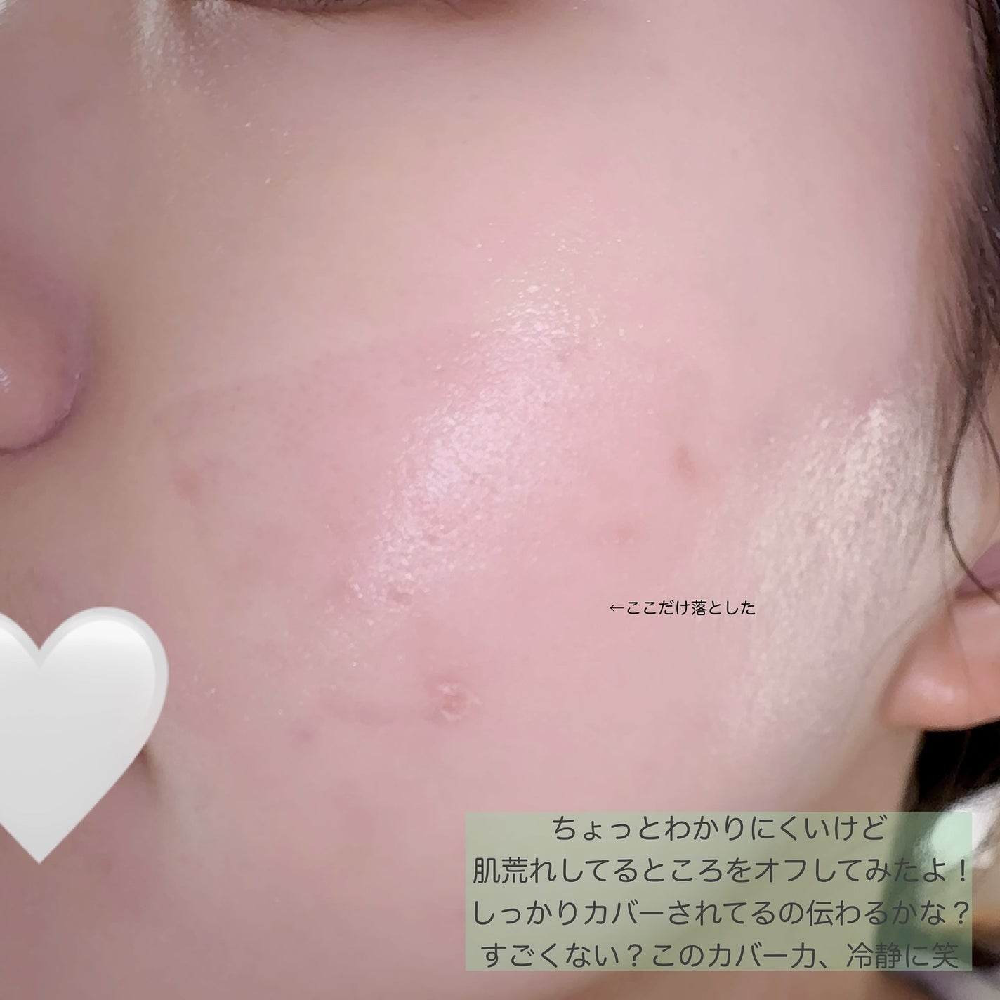 ダーマシンコンシーラー/23years old/リキッドコンシーラーを使ったクチコミ(5枚目)