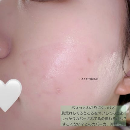 ダーマシンコンシーラー/23years old/リキッドコンシーラーを使ったクチコミ(5枚目)