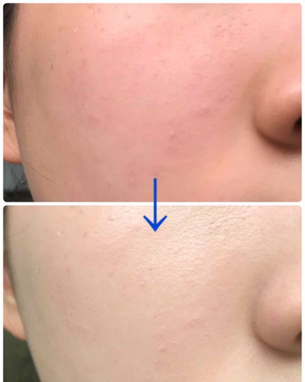 M クッションファンデーション(ネオカバー)/MISSHA/クッションファンデーションを使ったクチコミ(4枚目)