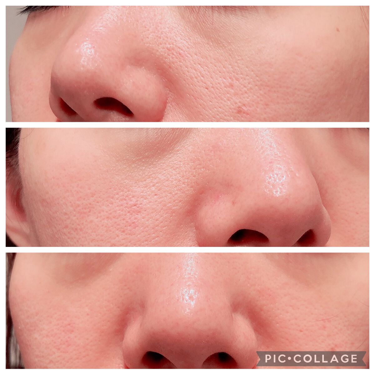 5種のセラミド配合化粧水/Aoyama・Labo/化粧水を使ったクチコミ（2枚目）